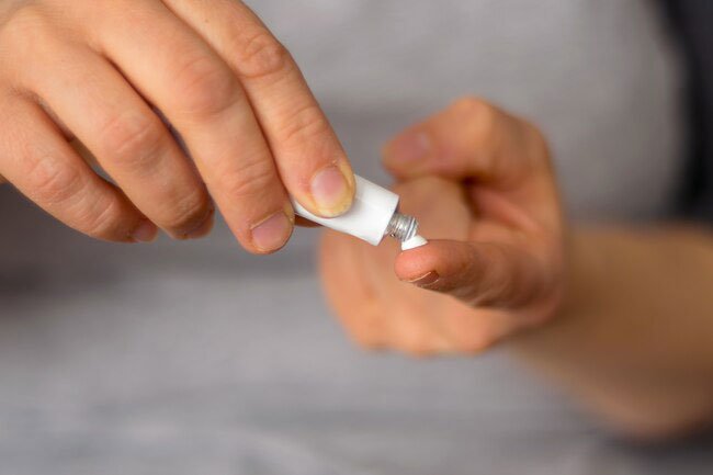 Using more than a small amount of retinoid can cause itching, redness, or drying.