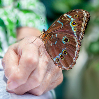 Initially, rheumatoid arthritis (RA) may affect one joint or a few joints.