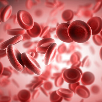 The inflammation of RA may cause anemia.