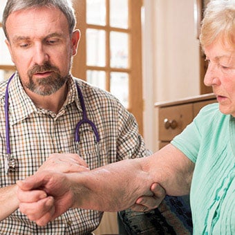 A doctor examines a patient for joint warmth, a symptom of active rheumatoid arthritis (RA) inflammation.