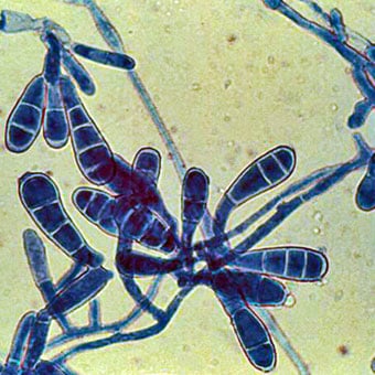 Several types of skin fungi cause ringworm.