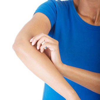 Ringworm causes an itchy rash.
