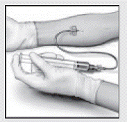 Insert the needle into the vein and remove the tourniquet - Illustration