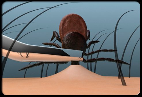 To remove a tick, grasp the tick as close to the skin surface as possible and pull upward with steady, even pressure.