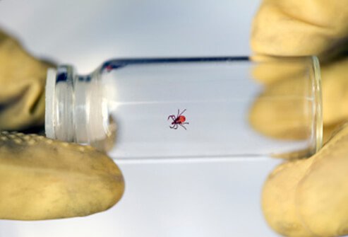 It may not be appealing, but it is a good idea to save the tick for identification in case you become ill later.