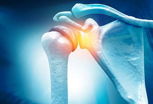 Tendons are flexible bands of thick tissue that connect your muscles to bones.