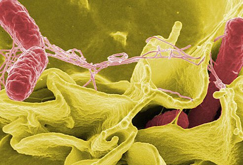 Knowing what kind of strain has caused a <i>Salmonella</i> outbreak helps scientists control the spread.