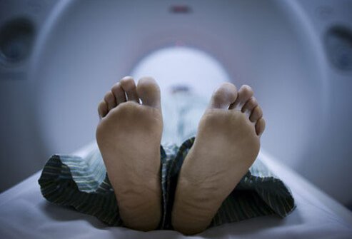 Various tests, such as MRI scans, CT scans, and others, may be used to help detect the cause of sciatica.