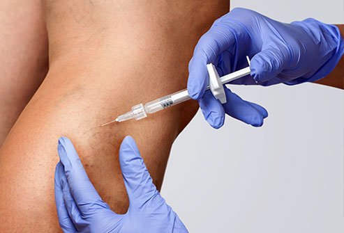 Sclerotherapy involves injecting a sclerosing agent into varicose veins and other damaged blood vessels to improve their appearance and reduce itching and burning symptoms.