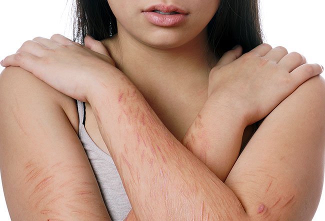warning signs of self-harm