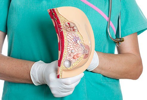 The first lymph nodes that drain lymph fluid from the primary tumor are called sentinel lymph nodes.