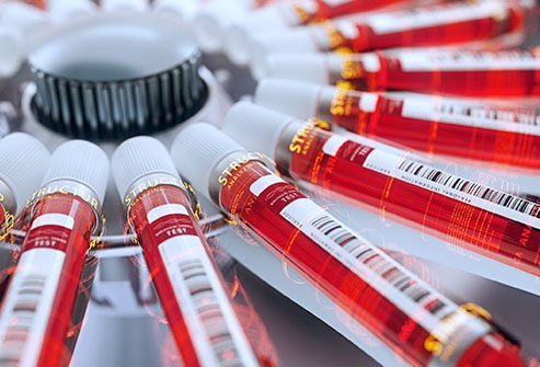 COVID-19 antibody test
