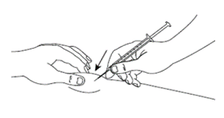 Insert the needle into the pinched skin at a 45 degree angle - Illustration