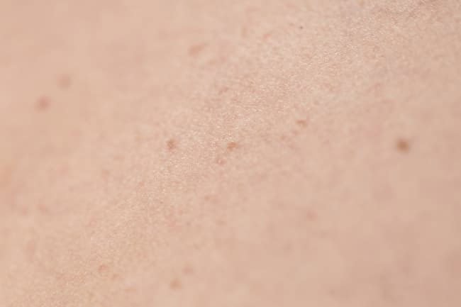 If your skin doesn't have enough water, it may look dull. 