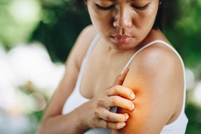Dry or dehydrated skin may lead to cracking and itching. 