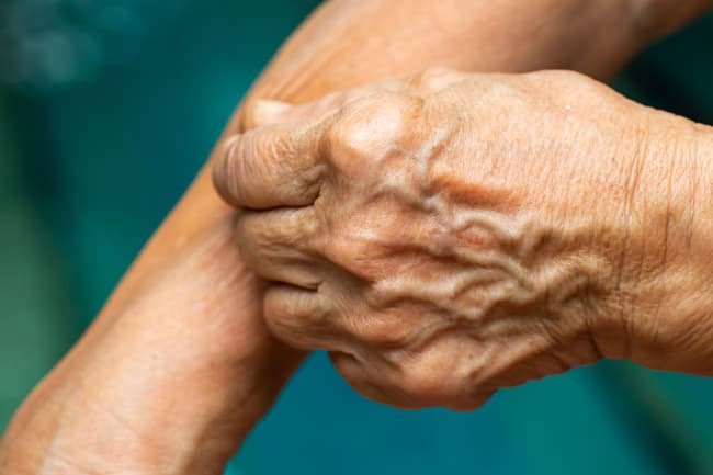 Try the pinch test on your arm to assess your level of hydration. 