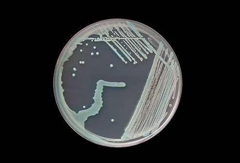 Your body hosts Candida yeast naturally in your gut, beginning soon after you are first born.
