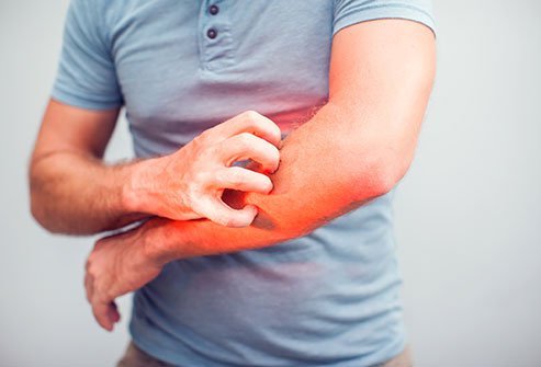 A variety of conditions can cause red spots, such as infectious and allergic. A variety of conditions can cause red spots, such as infectious and allergic.