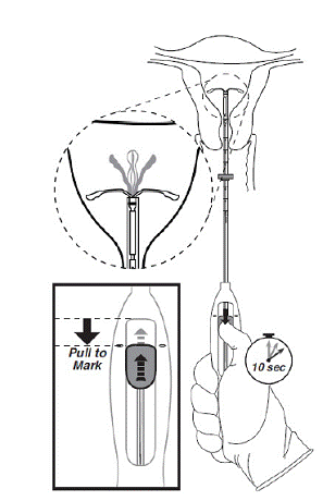 Move the slider back to the mark to release
and open the arms - Illustration Move the slider back to the mark to release
and open the arms - Illustration