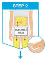 Injectable Areas - Illustration Injectable Areas - Illustration