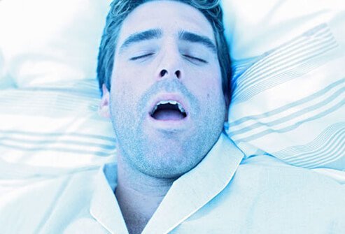 Sleep apnea is a disorder that causes a person to stop breathing many times while they are sleeping.