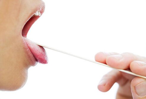 A sore throat that does not respond to initial medical treatment may be a sign of another cause.