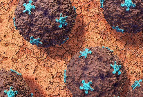 Because strep throat is caused by a bacterium, bacteria-fighting antibiotics are usually used to cure the disease.