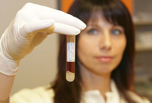 There are accurate tests to identify whether or not you have been infected with the HIV virus.
