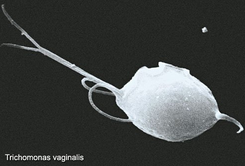 Most affected men have no specific symptoms of trichomoniasis.