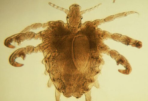This name refers to the shape of these parasites, which is different from that of body lice.
