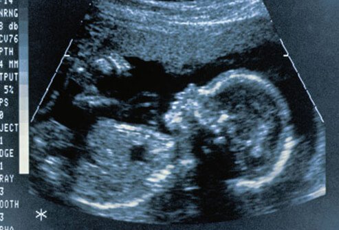 Some STDs can cause premature labor in pregnant women.