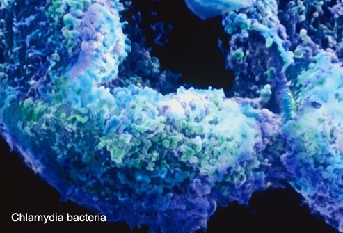 Chlamydia is a very common STD.