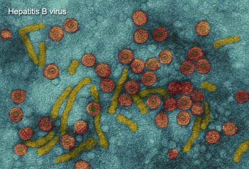 Hepatitis B is a virus that spreads through contact with body fluids and blood, so it can be transmitted through sexual intercourse.