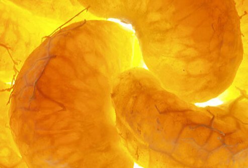 Orange slices.