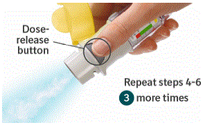 Turn, Open, Press (TOP) - Illustration Turn, Open, Press (TOP) - Illustration