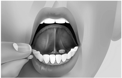 To open your SUBOXONE sublingual film foil pouch, fold along the dotted line - Illustration