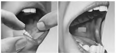Place one film on the inside of your right or left cheek - Illustration