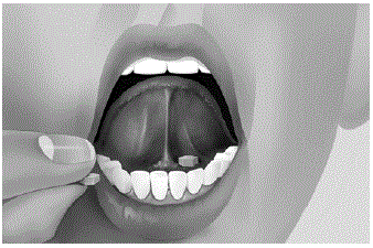 Put the tablets under your tongue - Illustration Put the tablets under your tongue - Illustration