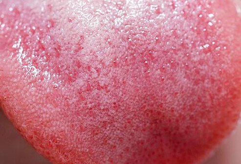 Try cutting out one sweet food from your diet each week.