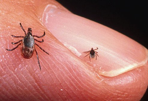 Protect yourself from ticks that can harbor Lyme disease and other illnesses.