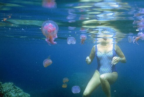 Venom in tentacles of jellyfish can cause painful stings.