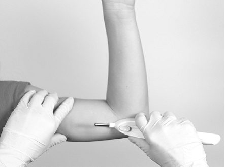 Inserting the Implant - Illustration