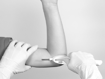 Inserting the Implant - Illustration