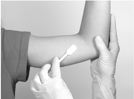 Swab the insertion area with topical antiseptic - Illustration