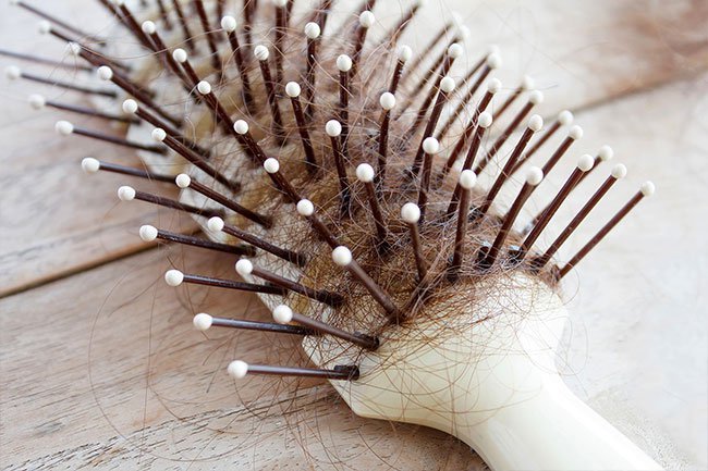 A type of hair loss called alopecia areata, is due to immune system problems. 