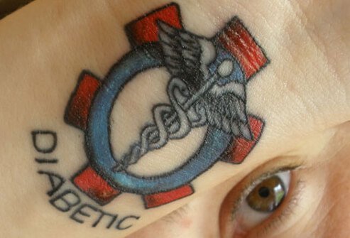 Diabetic Medical Alert Tattoo