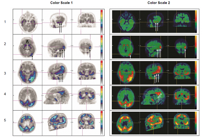 Positive Scan Examples - Illustration Positive Scan Examples - Illustration