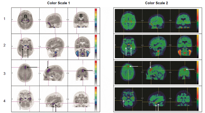 Negative Scan Examples - Illustration Negative Scan Examples - Illustration