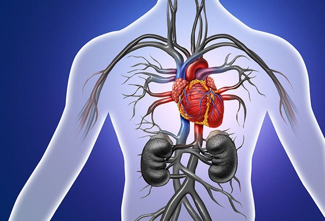 Tetralogy of Fallot or TOF is a congenital (present since birth) heart defect that affects the normal flow of blood in the heart. 