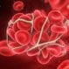 Pulmonary Embolism (Blood Clot in the Lung)